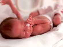 مشکلات شایع نوزادان نارس