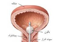 راهنمای خودمراقبتی بیماران بیمار دارای سوند فولی