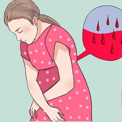 راهنمای بالینی خونریزی در بارداری